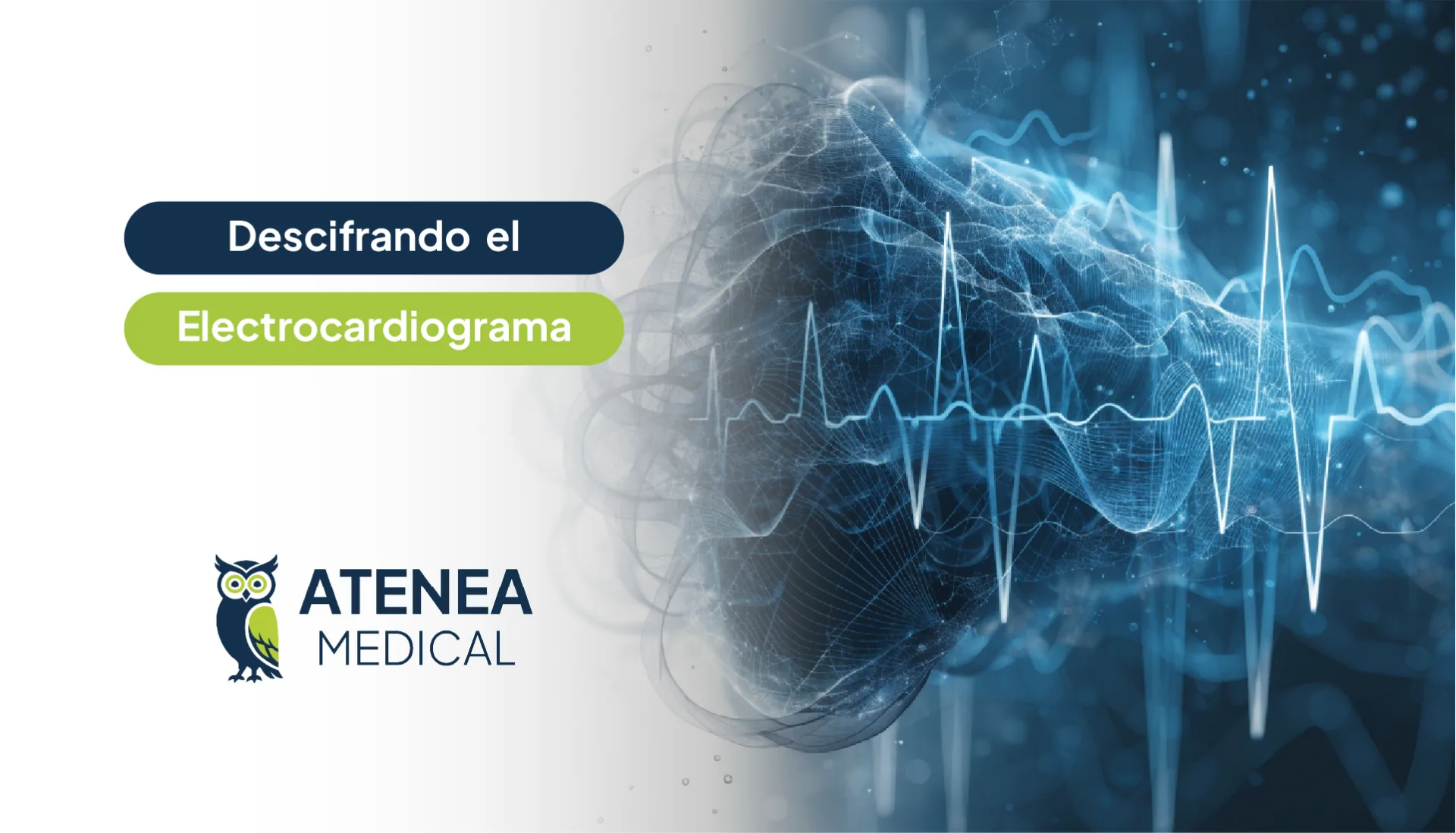 Descifrando el Electrocardiograma