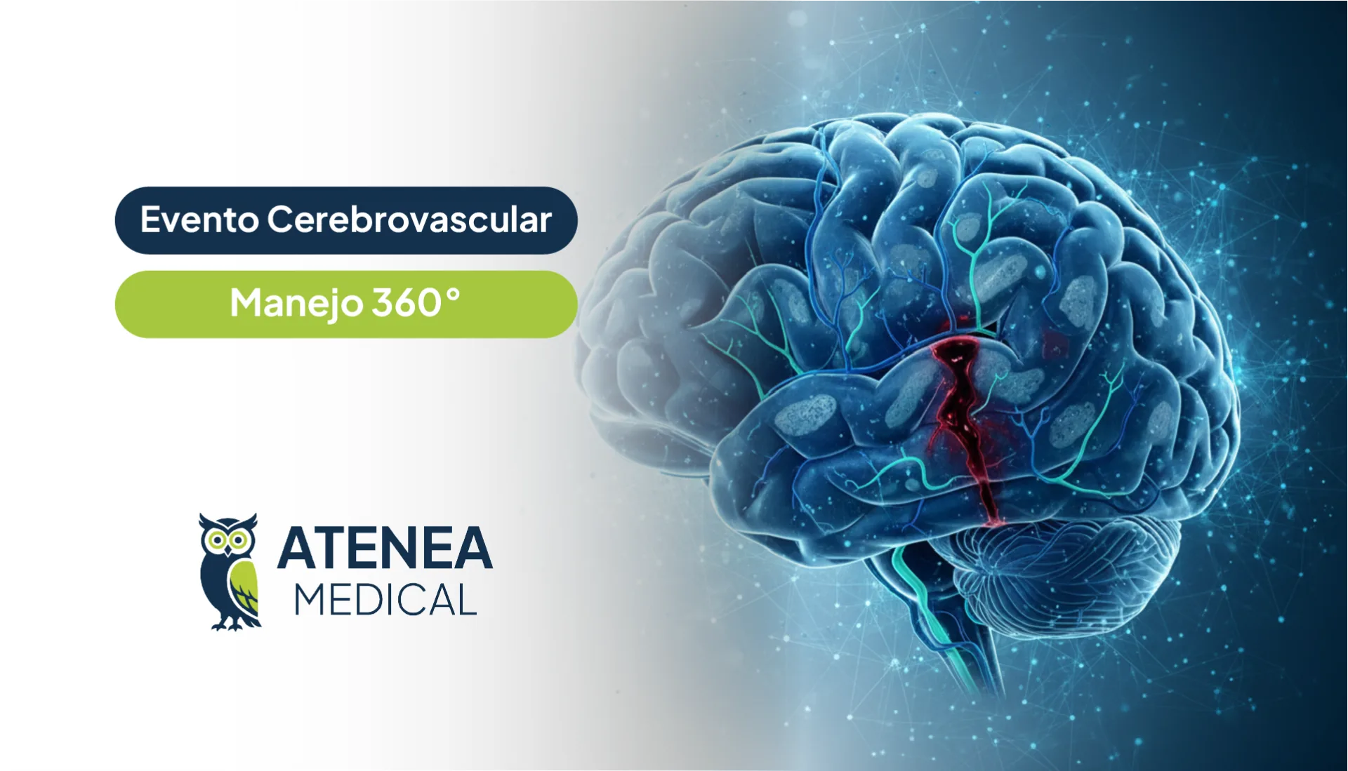 Evento cerebrovascular: Manejo 360°