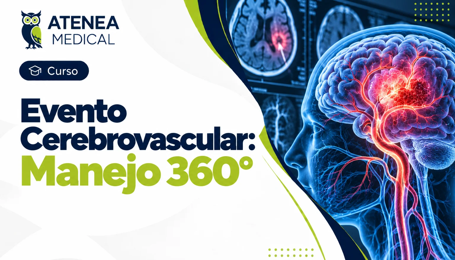 Evento cerebrovascular: Manejo 360°