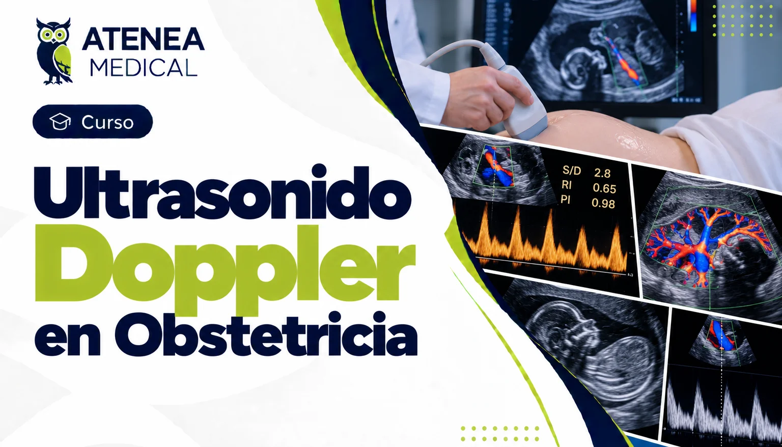 Ultrasonido Doppler en Obstetricia